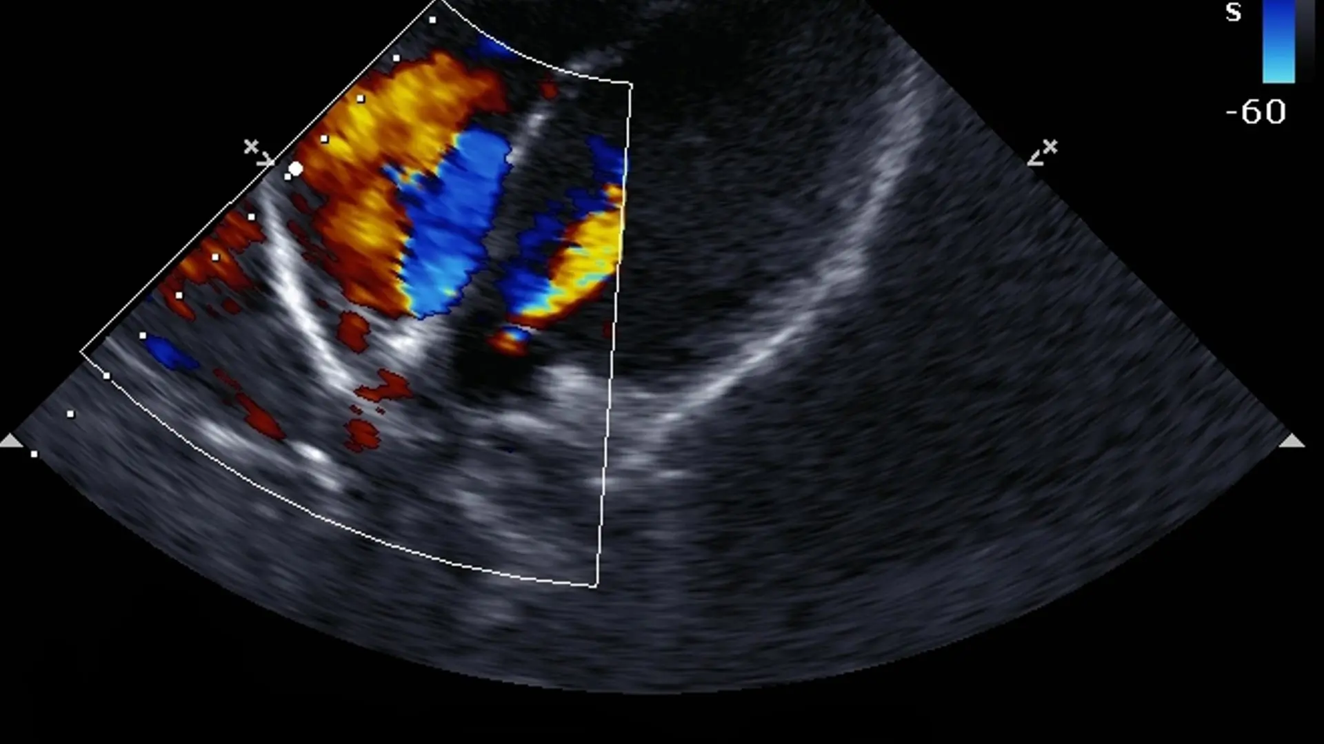 Doppler vascular - Dr. Ilan Cardoso