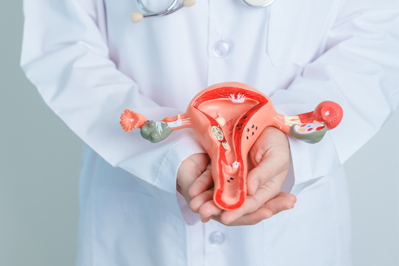 Pesquisa de endometriose - Dr. Ilan Cardoso